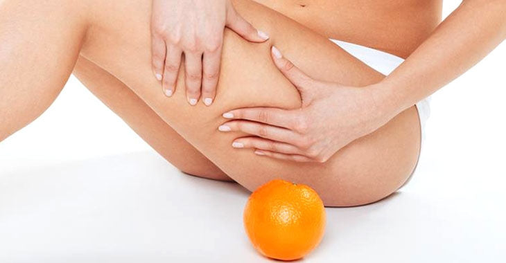 BUONE ABITUDINI PER SCONFIGGERE LA CELLULITE Ecosalute